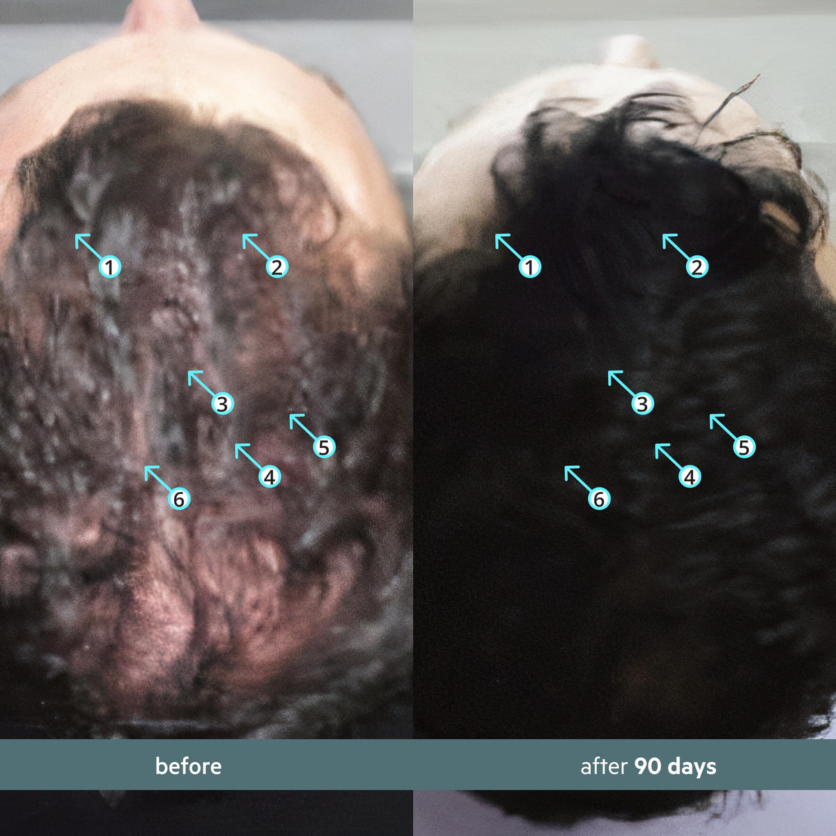 DS Labs Spectral Booster Hair Density Serum - 60mL - image 3