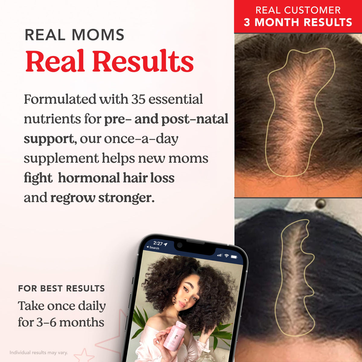 HAIRtamin MOM Prenatal & Postnatal Hair Vitamins - 30 Capsules - image 4