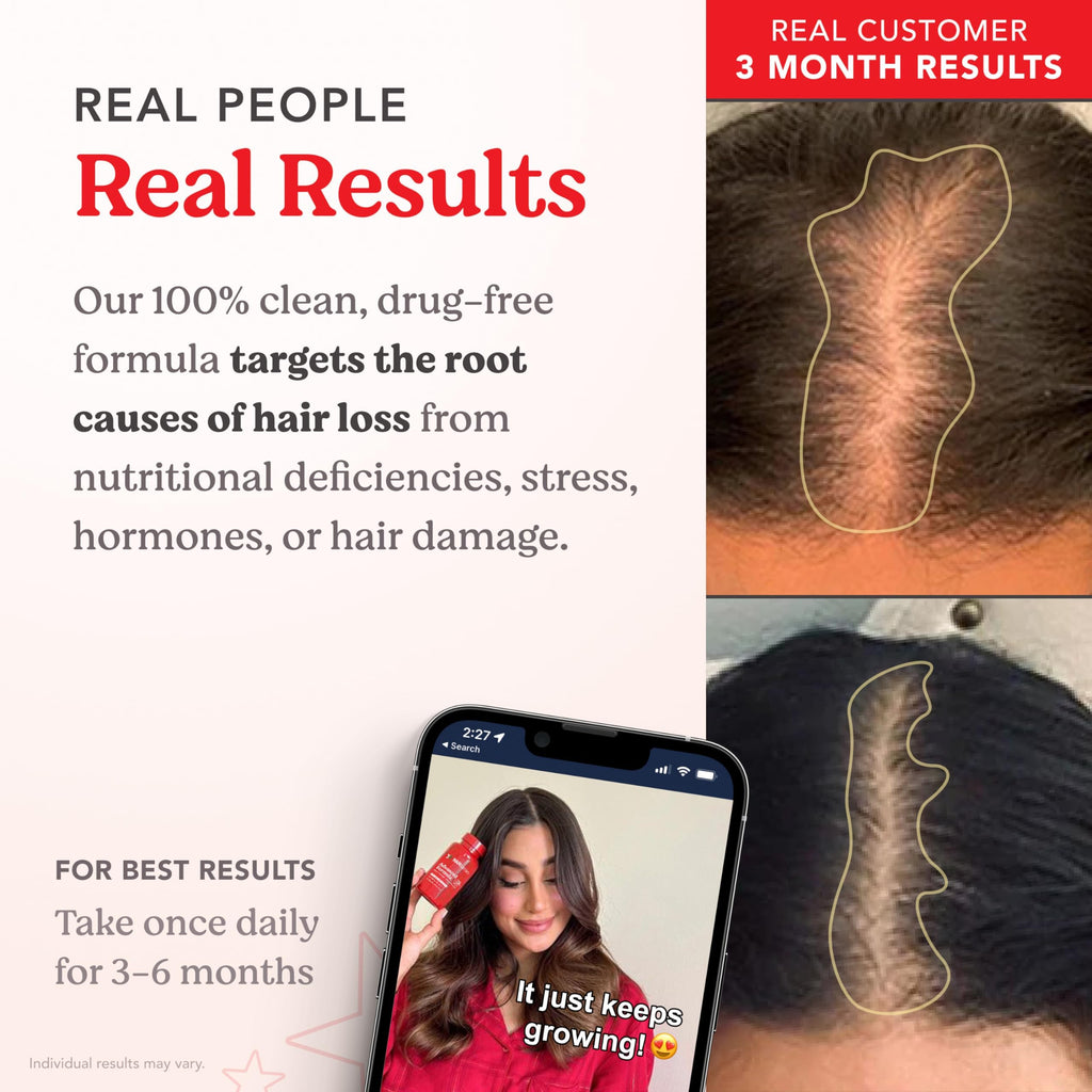 HAIRtamin Vegan Hair Vitamins for Faster Growth
