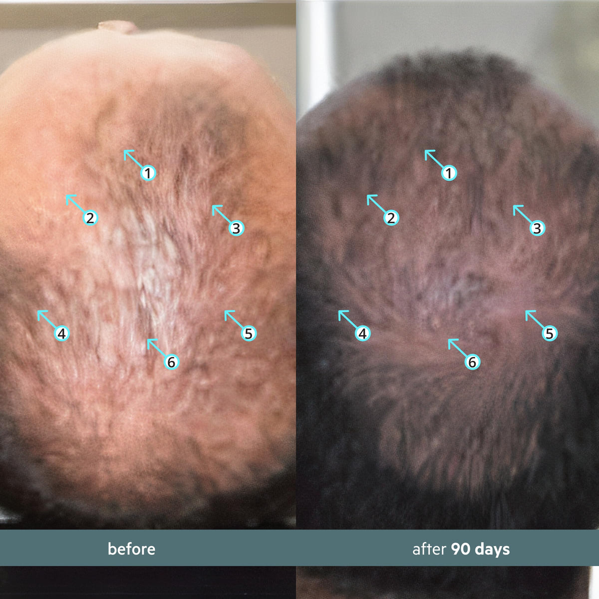 DS Labs Spectral Booster Hair Density Serum - 60mL - image 4