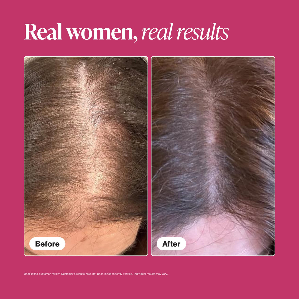 Viviscal Hair Growth Supplements for Women - 60 Tablets - image 6