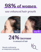 Keranique Hair & Scalp Supplements - Promote Strength and Growth