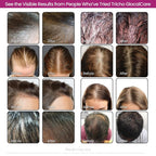 GlocalCare Tricho Hair Growth Supplement with Biotin & Saw Palmetto - image 8