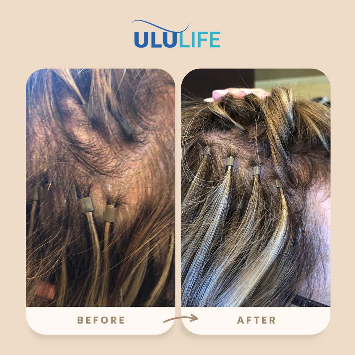 ULULIFE Hair Growth Vitamins for Men & Women - Advanced Multivitamin