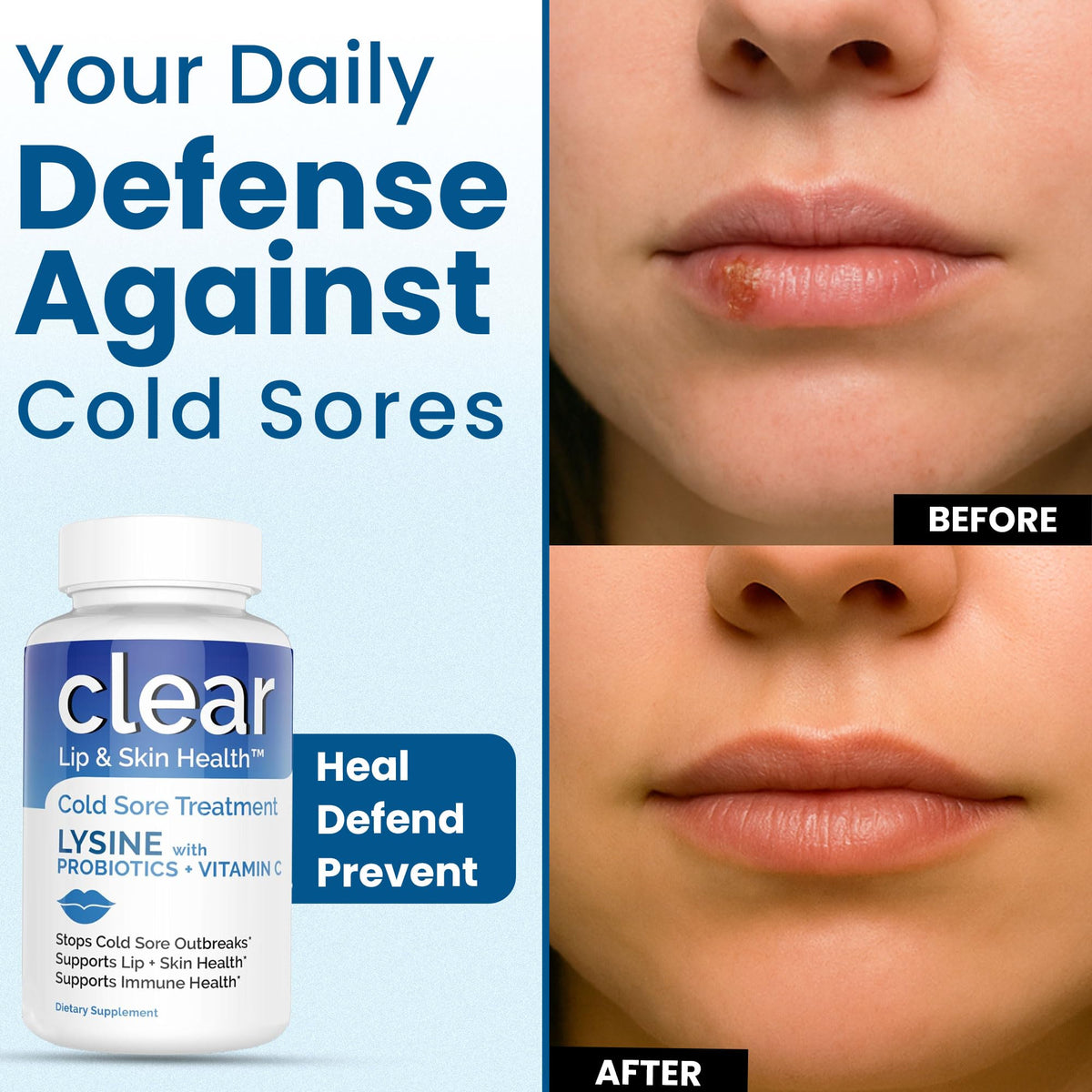 Clear Probiotics Lysine Cold Sore Treatment for Lips - image 5