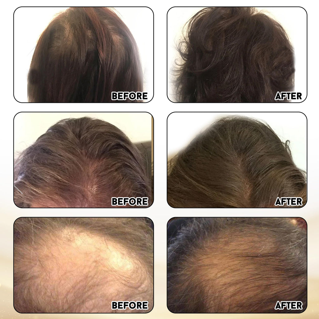 Miracle Elixir Collection Joyce Giraud Ultimate Hair Strength Supplements - image 6