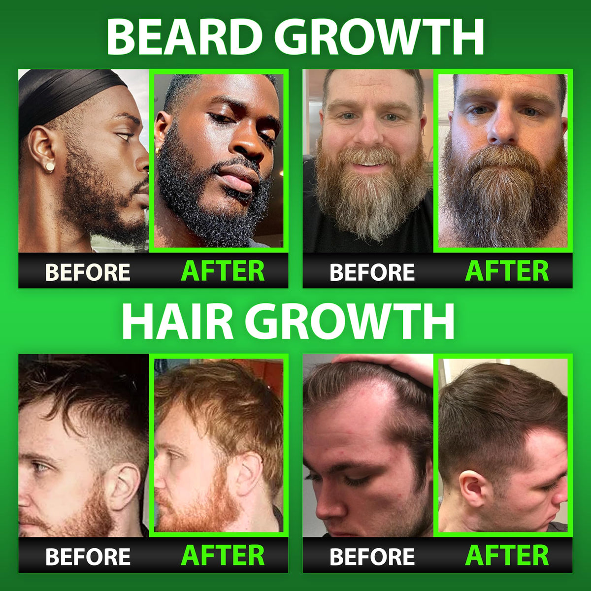 BBS Best Beard Stuff Biotin Gummies for Beard & Hair Growth - 60 Count - image 2