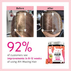 Bears with Benefits Biotin 5,000 mcg Hair Growth Gummies