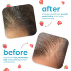 Artnaturals Biotin Gummies Strawberry - 100 Count - image 5