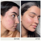 jane iredale Skin Accumax Supplement - 30-Day Supply - image 5