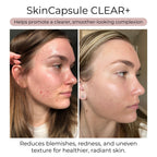 Hush & Hush Acne Supplement for Clear Skin - 60 Capsules - image 3