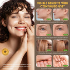 Generic Collagen Patches with Vitamin C & Peptides - 30 Patches - image 7