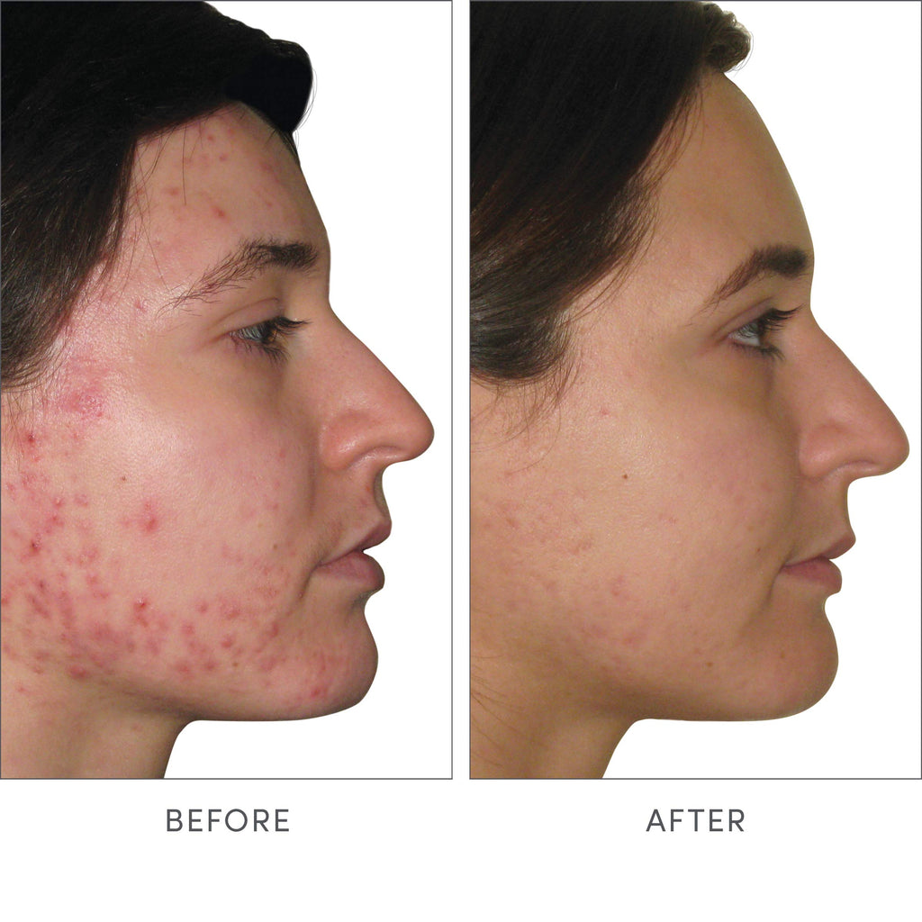 jane iredale Skin Accumax Supplement - 30-Day Supply - image 3
