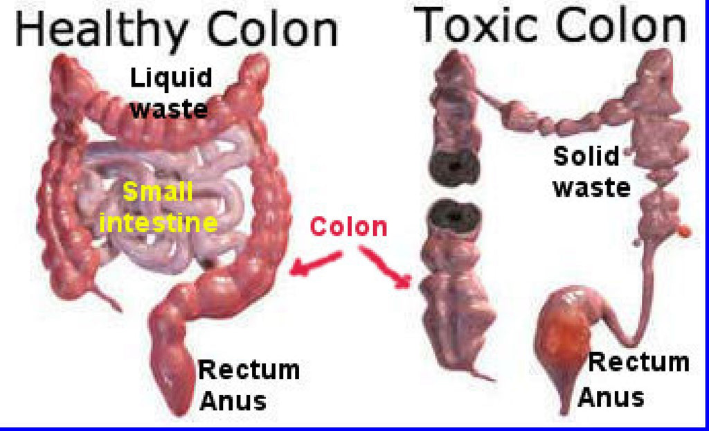 The One Minute Miracle - Miracle Oxy-Cleanse Colon Cleanse for 1