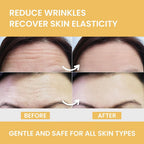 MONIER Forehead Wrinkle Patches Smoothing Overnight - 12 Count - image 3