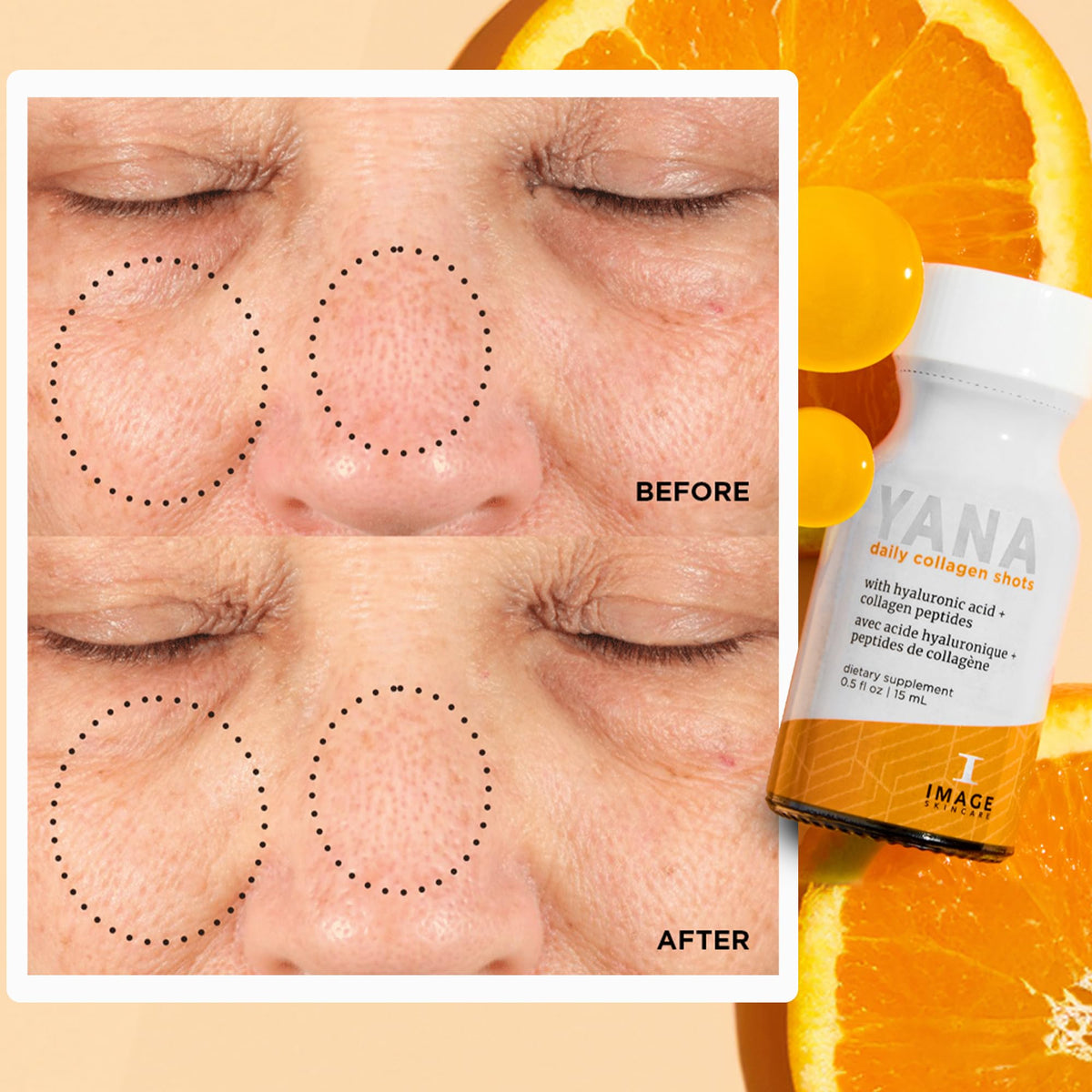 IMAGE Skincare YANA Liquid Collagen Shots - 28 Daily Shots - image 4