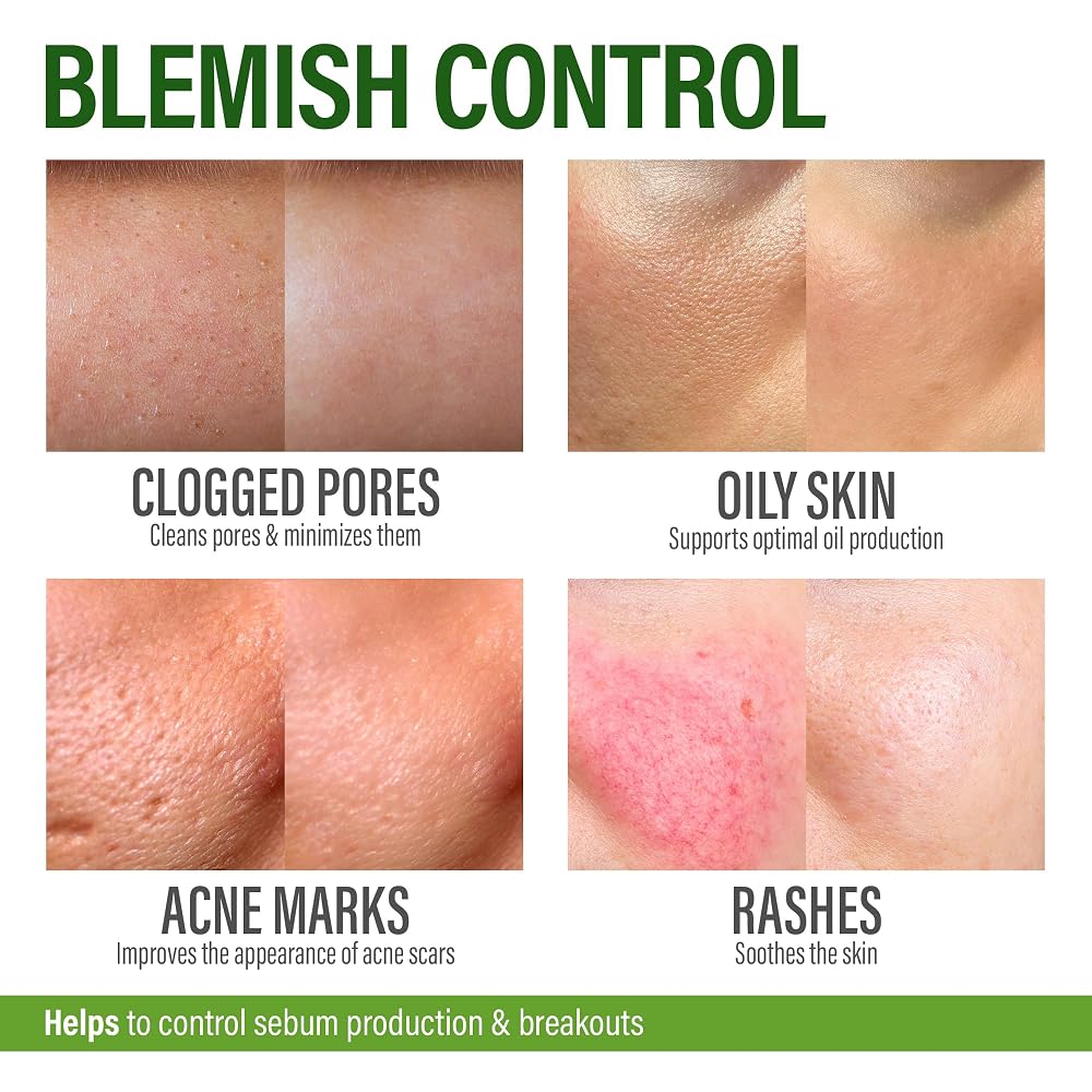 GRAMRIGHT Perfect Skin Pills Clear Skin Supplement - 60 Capsules - image 4