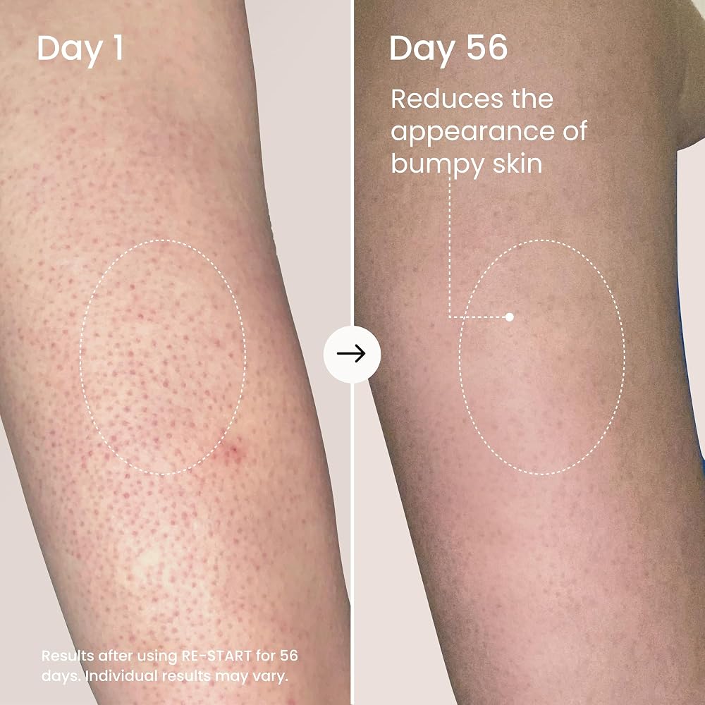 MAËLYS RE-START Resurfacing Body Serum with AHA - 3.5 Fl Oz - image 3